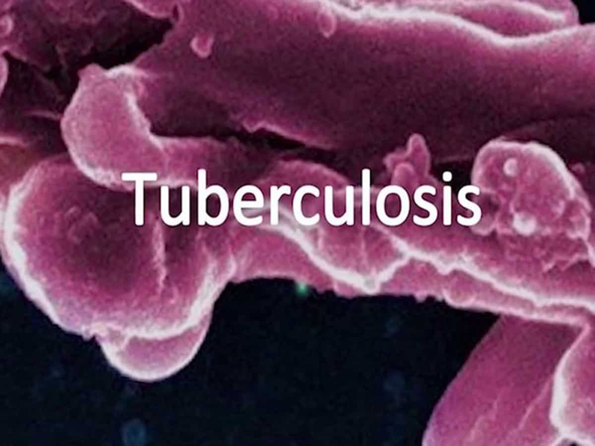 Treatment length for children with tuberculosis now reduced: Research