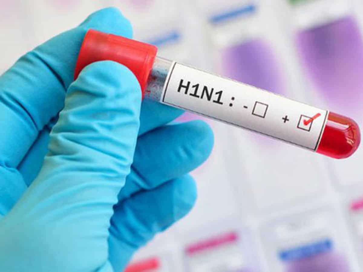 Image result for Swine flu or H1N1