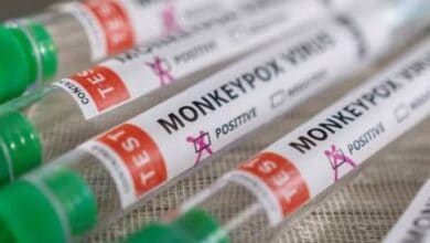 Jordan detects first monkeypox case